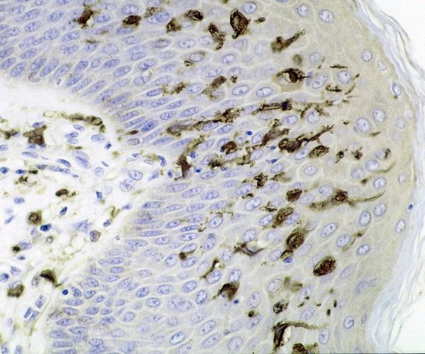 Dendritic_cells