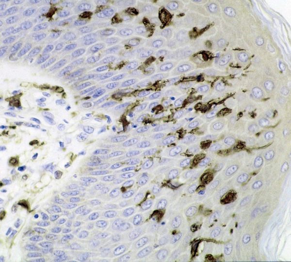 Dendritic_cells